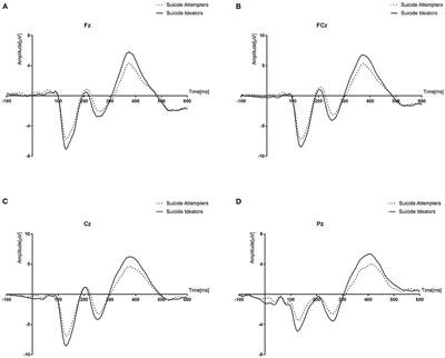 Electrophysiological Changes Between Patients With Suicidal Ideation and Suicide Attempts: An Event-Related Potential Study